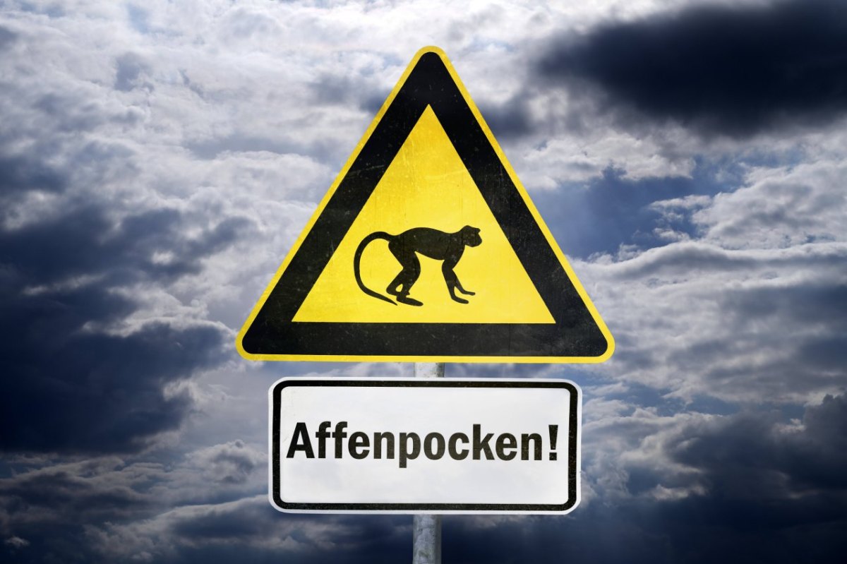 Affenpocken.jpg