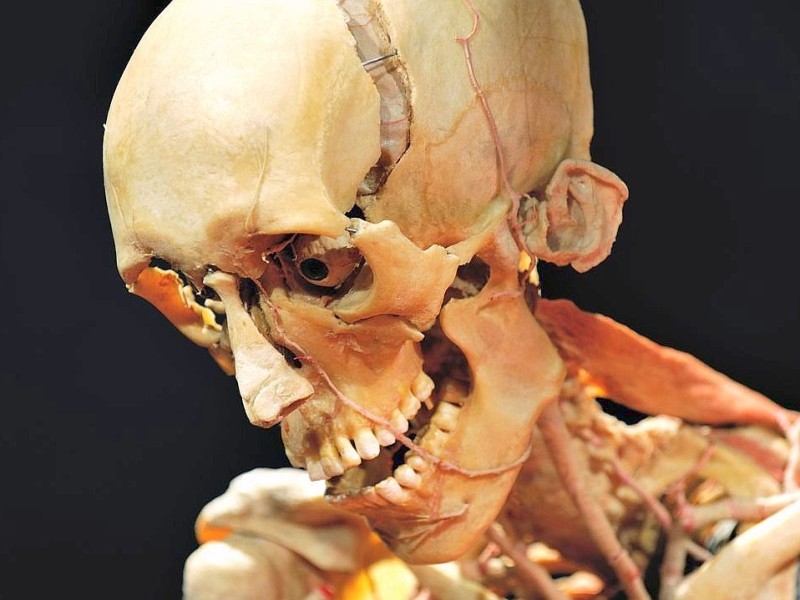 Die Themenausstellung Körperwelten und der Zyklus des Lebens mit Plastinaten des menschlichen Körpers ist erstmals im Ruhrgebiet zu sehen, in Bochum an der Hermannshöhe, am Donnerstag, den 29. August  2013 in Bochum.  Foto: Ingo Otto / WAZ FotoPool