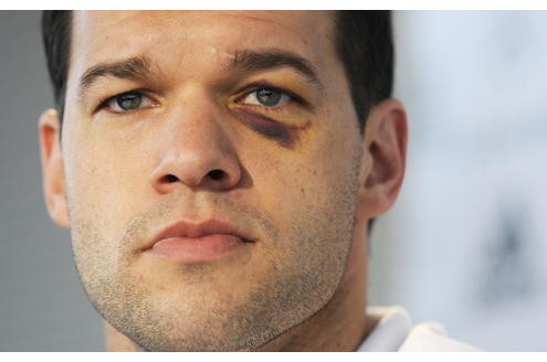 Ballack holte sich zwar auch mal ein blaues Auge ...